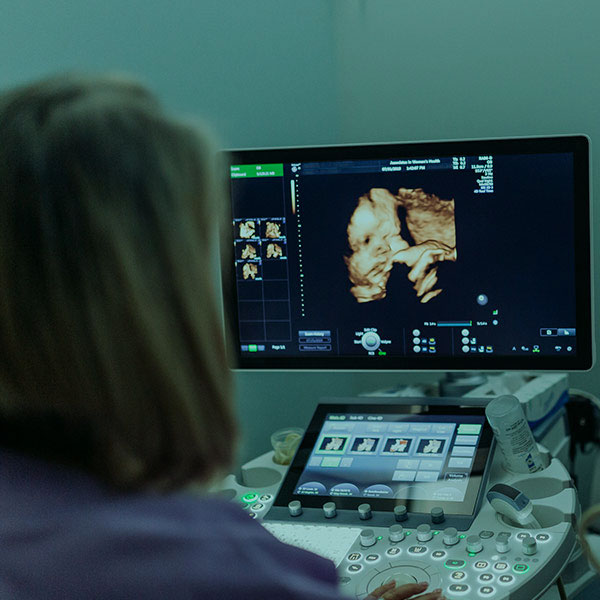 3D / 4D Ultrasound