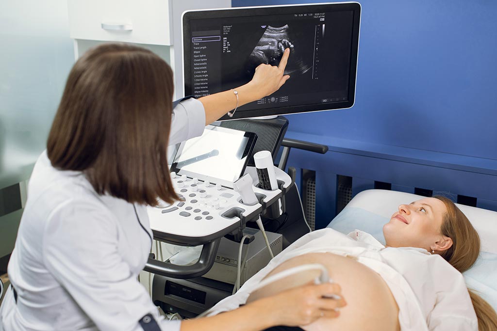 Don’t Believe These Myths About Ultrasounds