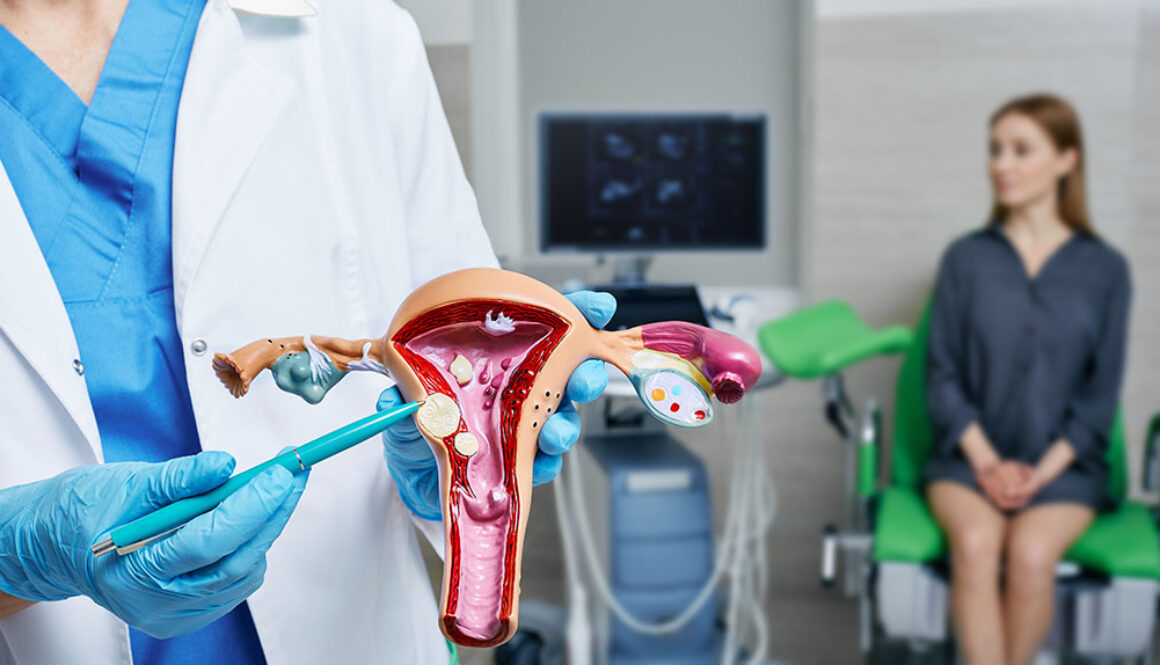 A Closeup of a Gynecologist Holding an Anatomical Model of Uterus Pointing to Fibroids With a Patient Sitting on Exam Table in the Background Are Fibroids Cancerous
