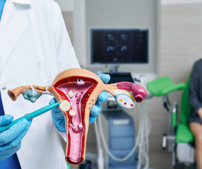 A Closeup of a Gynecologist Holding an Anatomical Model of Uterus Pointing to Fibroids With a Patient Sitting on Exam Table in the Background Are Fibroids Cancerous