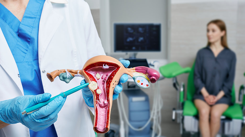 A Closeup of a Gynecologist Holding an Anatomical Model of Uterus Pointing to Fibroids With a Patient Sitting on Exam Table in the Background Are Fibroids Cancerous