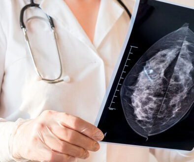 Closeup Of An Obgyn Doctor Examining An Image From A Mammogram Scan Mammogram Call Back