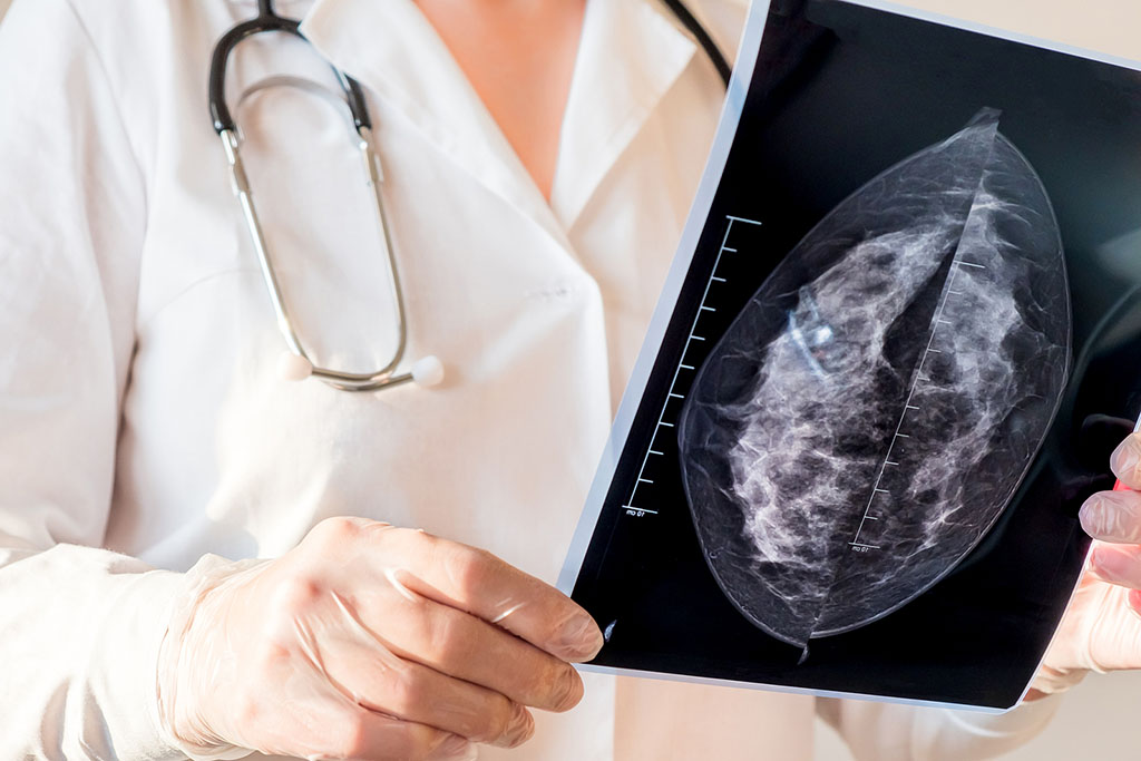 Closeup Of An Obgyn Doctor Examining An Image From A Mammogram Scan Mammogram Call Back